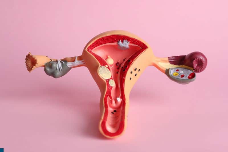 women-uterus