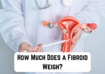 How Much Does a Fibroid Weigh? (Detailed Guide)